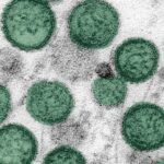 Hantavirus: el riesgo general para la salud pública sigue siendo bajo