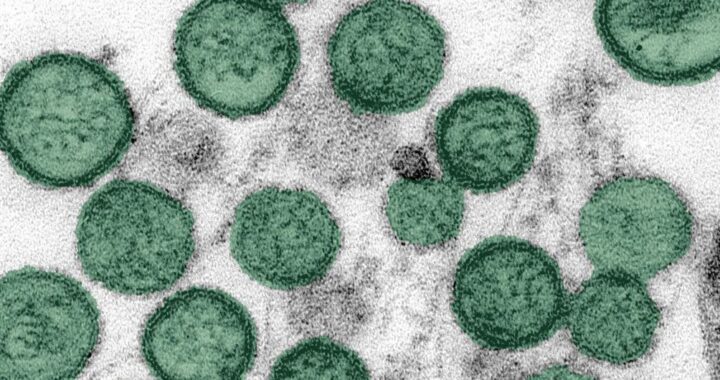 Hantavirus: el riesgo general para la salud pública sigue siendo bajo